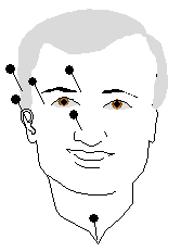 acupuncture Molimard tabac fumer